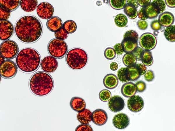 Haematococcus,pluvialis,green,and,cyst,algae,under,microscopic,view,